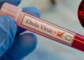 Congo Ebola outbreak deaths - تفشي إيبولا في الكونغو