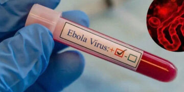 Congo Ebola outbreak deaths - تفشي إيبولا في الكونغو
