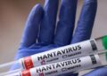 hantavirus prevention measures - فيروس هانتا الوقاية