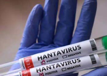 hantavirus prevention measures - فيروس هانتا الوقاية