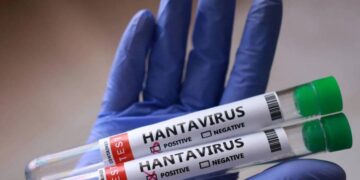 hantavirus prevention measures - فيروس هانتا الوقاية